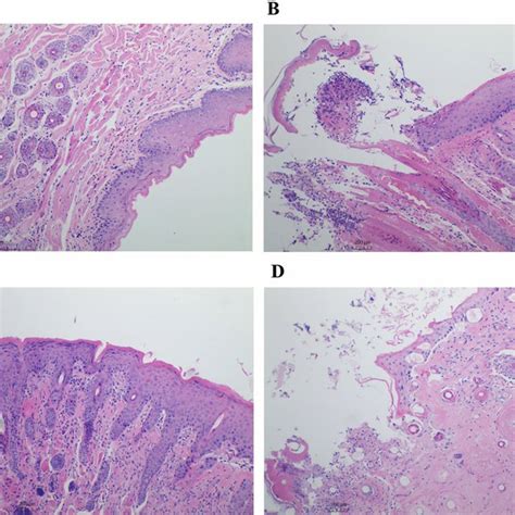 Histopathology Of Oral Mucosa Necropsy A Oral Mucosa Tissue Of Download Scientific Diagram