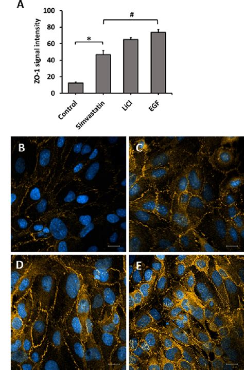 Figure 1 From Assessment Of Zonula Occluden 1 Expression By Wnt β Catenin Pathway Activators In