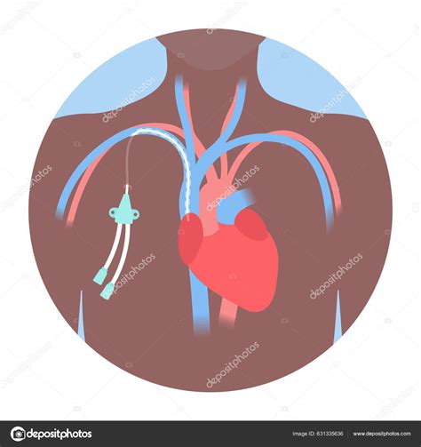 Coraz N Arteria Derivaci N Pecho Tubo Imagen Vectorial De Naumas