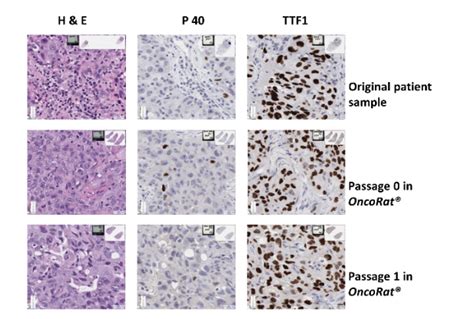 Pdx Establishment Nsclc Models Hera Biolabs