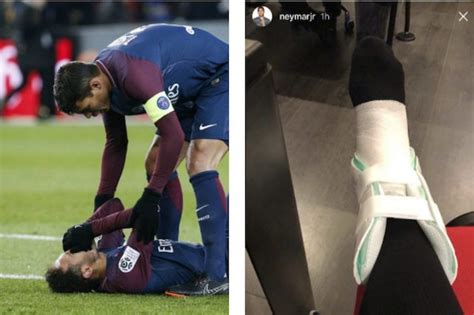 Infortunio Alla Caviglia Per Neymar La Foto Su Instagram Che Preoccupa