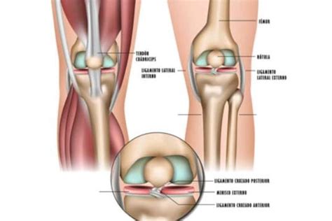 S Ntomas De La Rotura De Menisco Gu A Completa