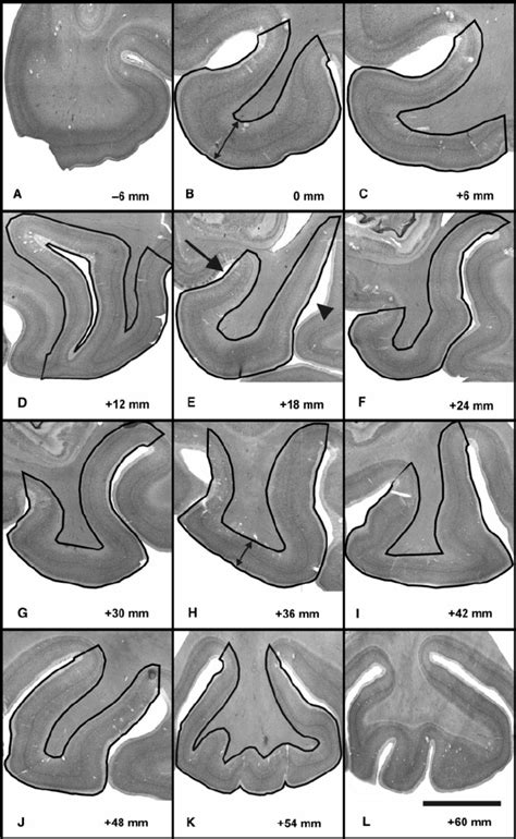 Representative photomicrographs of 200 m m thick coronal sections ... 
