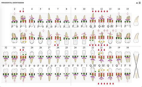 Periodontal Charting Overview ICE Health Systems Help