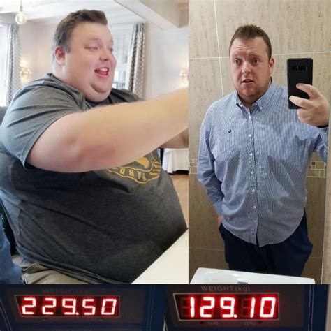 Capetonian Achieves 100kg Weight Loss