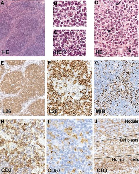 Histology And Immunohistochemistry Of The Lymph Node Nodular