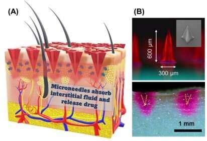 Rethinking How Drugs Are Administered A Breakthrough In Microneedle