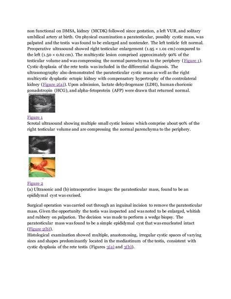 Cystic Dysplasia Of The Rete Testis Pdf