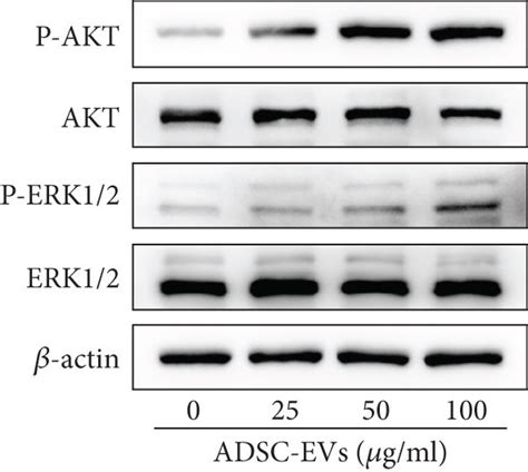 Adsc Evs Promote The Proliferation And Migration Of Cells Via The