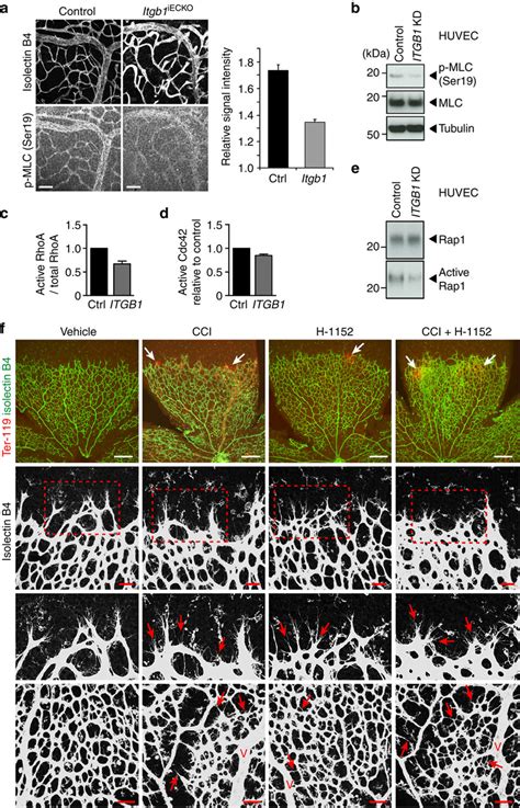 Role Of Actomyosin Contractility A Reduced Vascular Phospho MLC