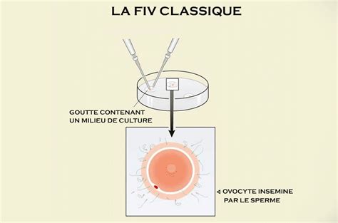 Centre Pma Et Fiv Casablanca Maroc Fertilit