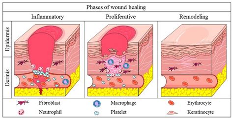 Phases Of Physiological Wound Healing Inflammatory Phase Hemostasis