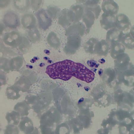 Leishmania Donovani Amastigotes In Macrophage Giemsa Stain