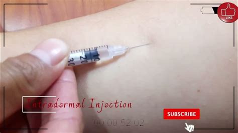 Intradermal Injection Youtube