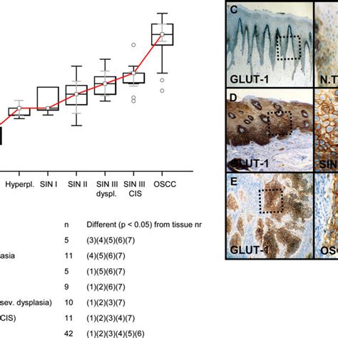 Immunohistochemical Analysis And Staining Of Glut In Normal Oral