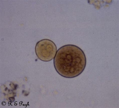 Entamoeba Histolytica Cyst