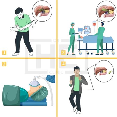 Gallbladder Surgery Cholecystectomy Turkey