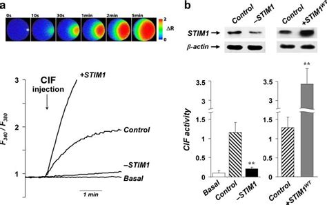 Down Regulation Of Stim Impairs Cif Production In Smooth Muscle Cells