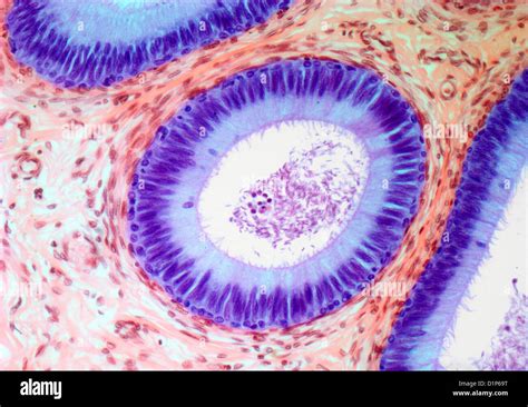 Epididymis Light Micrograph Stock Photo Alamy