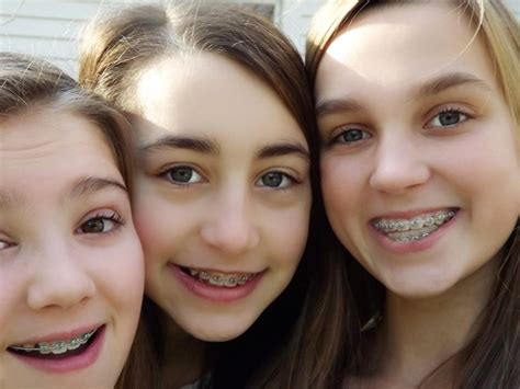 Alt Girl Braces Xxx Porn