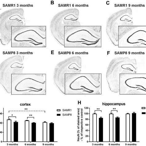 Decreased total number of neurons in the cortex and hippocampus of ... 