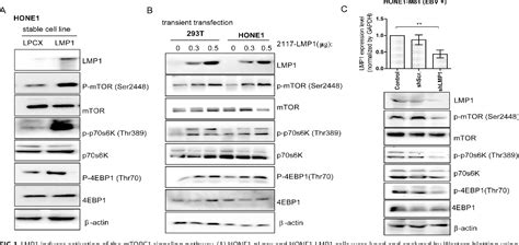 Figure 1 From Epstein Barr Virus Encoded Latent Membrane Protein 1