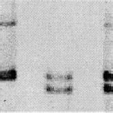 Agarose Gel Electrophoresis Of Gstm Gstt And Globin Pcr Product