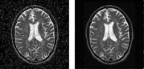 Median Filtering With Python And Opencv By Tony Flores Medium