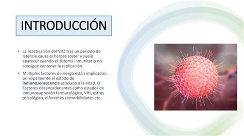 Herpes Zoster Ppt Ppt Descarga Gratuita