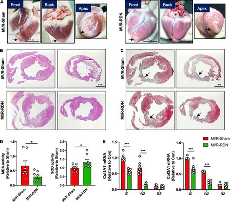 Frontiers Renal Denervation Attenuates Adverse Remodeling And