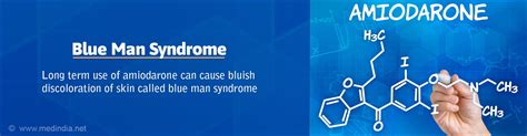 Blue Man Syndrome And Amiodarone Glossary