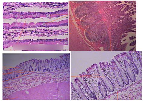 Histology Duodenum Colon Peyer S Patches Diagram Quizlet