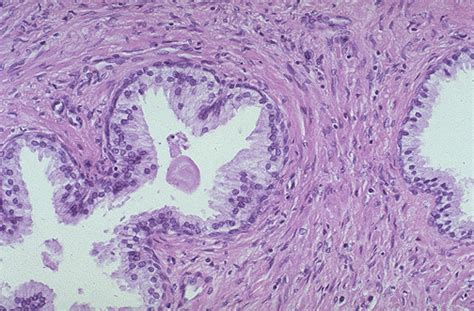 Prostate Applied Anatomy Epomedicine