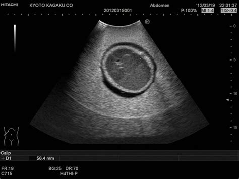 Fetus Ultrasound Examination Phantom Zara Test Cihazları