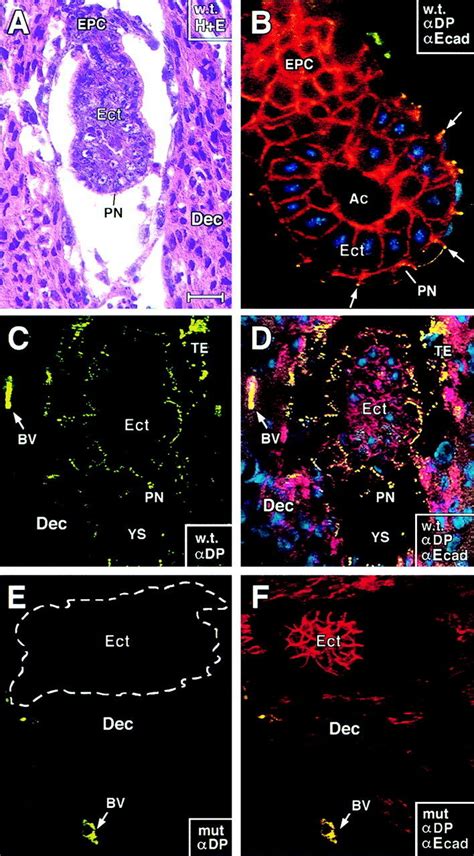 E5 0 DP Mutant Embryos Form And Appear Similar In Size And In