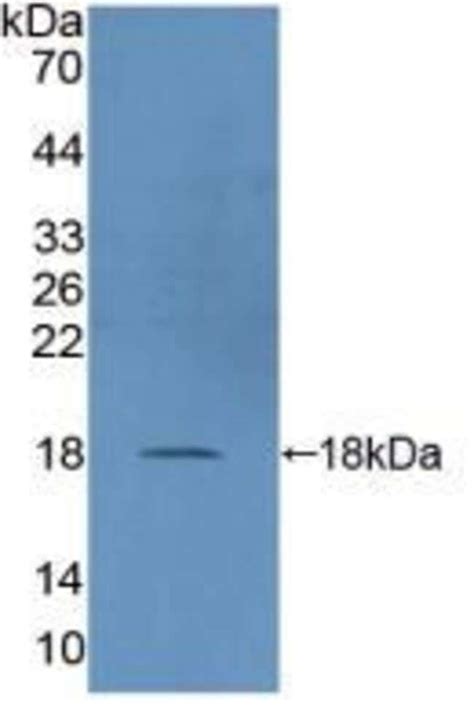 DUSP5 Polyclonal Antibody Invitrogen 100 μL Unconjugated Antibodies