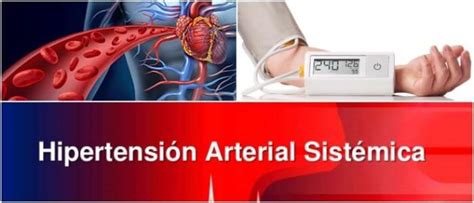 Hipertensión Arterial Sistémica Síntomas Causas Y Tratamiento Arriba Salud