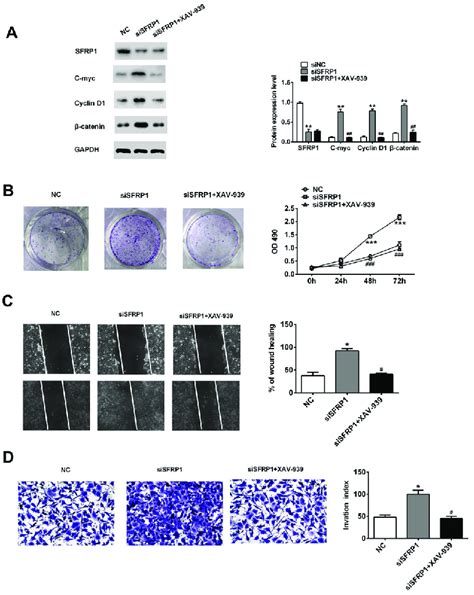 Sfrp Influenced Cells Proliferation Migration And Invasion Through