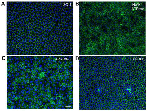 Ijms Free Full Text Corneal Endothelial Like Cells Derived From Induced Pluripotent Stem