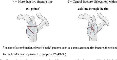 Figure 3 From The AO Foundation And Orthopaedic Trauma Association AO