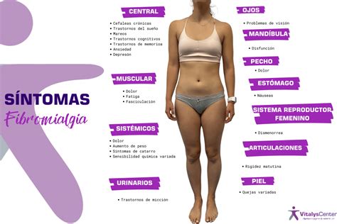 Aprender Sobre Imagem Fibromialgia Sintomas Fotos Br Thptnganamst