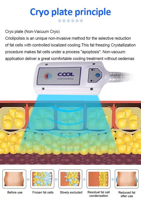 Cryolipolysis Radio Frequency Ems Freeze Fat Body Sculpting Machine