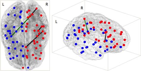 Representation Of Cortical Correlations In Apoe Carriers As Compared