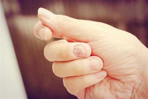 10 Disturbing Things Your Nails Reveal About Your Health Health