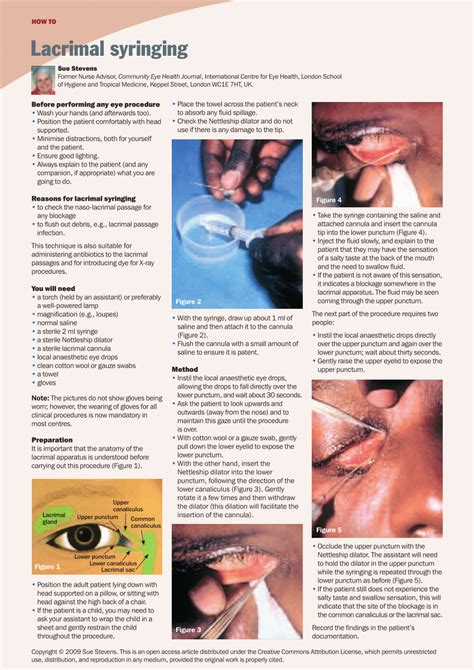 Pdf Lacrimal Syringing