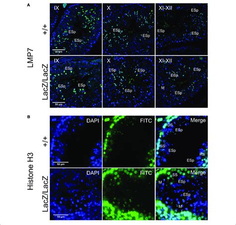 Immunochemical Staining Of LMP7 And Histone H3 In Fbxo7LacZ LacZ