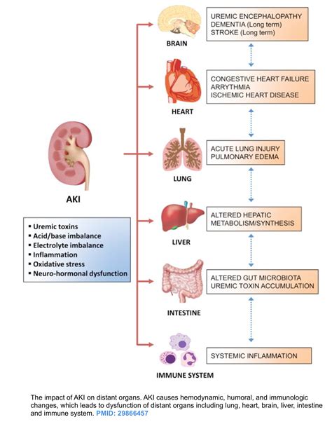 Acute Kidney Injury Pathophysiology Diagram Kidney Injury Acute ...