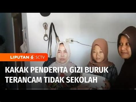 Kakak Bayi Yang Menderita Gizi Buruk Terancam Tak Sekolah Karena Tidak