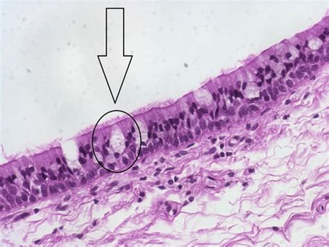 Histology Lecture L4 Glandular Epithelium Flashcards Quizlet