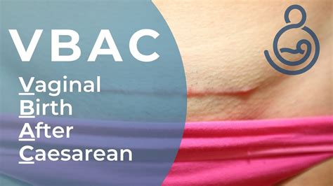 Vbac Vaginal Birth After Caesarean Youtube